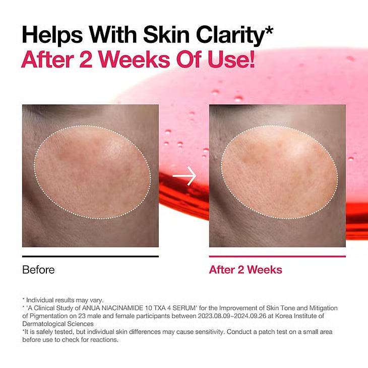 ANUA - Niacinamide 10% +TXA 4% Serum